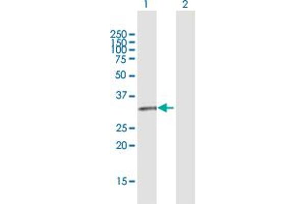 GPR146 anticorps  (AA 1-333)