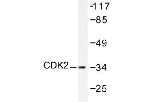 Image no. 1 for anti-Cyclin-Dependent Kinase 2 (CDK2) antibody (ABIN265344) (CDK2 anticorps)