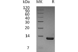 Greater than 95 % as determined by reducing SDS-PAGE. (CCL8 Protein (His tag))