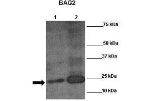 Sample Type: Lane 1:241 µg mouse mesenchymal stem cell lysate Primary Antibody Dilution: 1:0000Secondary Antibody: Anti-rabbit-HRP Secondary Antibody Dilution: 1:00,000 Color/Signal Descriptions: RUNX2  Gene Name: Anonymous Submitted by: (RUNX2 anticorps  (N-Term))
