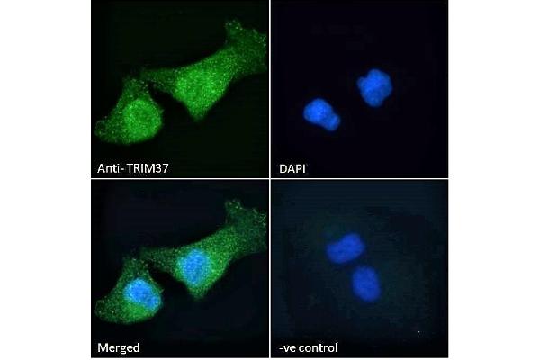 TRIM37 anticorps  (C-Term)