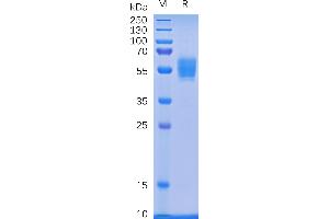 Human D Protein, mFc Tag on SDS-PAGE under reducing condition. (KLRK1 Protein (mFc Tag))