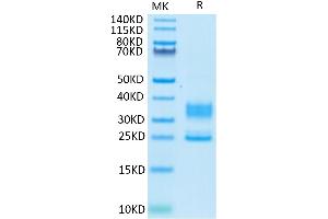 SDS-PAGE (SDS) image for CD3D & CD3E protein (His tag) (ABIN7274136)