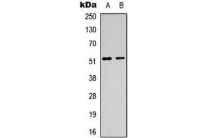 Western blot analysis of CHRM1 expression in HeLa (A), mouse brain (B) whole cell lysates. (CHRM1 anticorps  (Center))