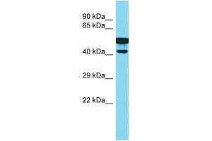 Host: Rabbit Target Name: CBWD2 Sample Type: Fetal Kidney lysates Antibody Dilution: 1. (CBWD2 anticorps  (C-Term))