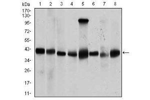 Image no. 2 for anti-Protein Phosphatase, Mg2+/Mn2+ Dependent, 1A (PPM1A) antibody (ABIN1491178) (PPM1A anticorps)