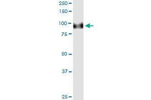 Immunoprecipitation of FBXO42 transfected lysate using rabbit polyclonal anti-FBXO42 and Protein A Magnetic Bead (FBXO42 (Humain) IP-WB Antibody Pair)