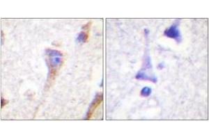 Immunohistochemistry (IHC) image for anti-Protein Kinase D1 (PRKD1) (AA 429-478) antibody (ABIN2888772) (PKC mu anticorps  (AA 429-478))