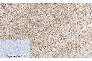 Immunohistochemical analysis of paraffin-embedded human uterus tissue. (Cyclin A anticorps  (AA 190-270))