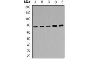 Western blot analysis of POR expression in Hela (A), MCF7 (B), mouse liver (C), mouse kidney (D), rat brain (E) whole cell lysates. (POR anticorps)