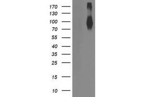 Western Blotting (WB) image for anti-Fibroblast Growth Factor Receptor 2 (FGFR2) antibody (ABIN1498250) (FGFR2 anticorps)