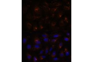 Immunofluorescence analysis of U-2 OS cells using ESYT1 antibody (ABIN7267069) at dilution of 1:100. (ESYT1 anticorps  (AA 90-220))