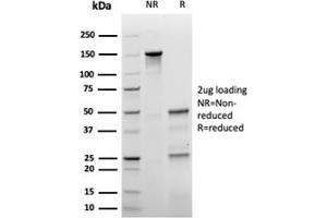 SDS-PAGE Analysis Purified p27 Recombinant Mouse Monoclonal Antibody (rKIP1/1356). (Recombinant CDKN1B anticorps)