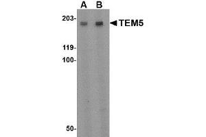 Image no. 1 for anti-G Protein-Coupled Receptor 124 (GPR124) (Internal Region) antibody (ABIN1493615) (GPR124 anticorps  (Internal Region))