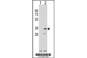 Western blot analysis of RPA2 using rabbit polyclonal RPA2 Antibody using 293 cell lysates (2 ug/lane) either nontransfected (Lane 1) or transiently transfected (Lane 2) with the RPA2 gene. (RPA2 anticorps  (N-Term))