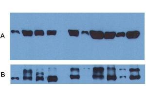 Western Blotting (WB) image for anti-alpha Tubulin (TUBA1) antibody (Biotin) (ABIN301997)