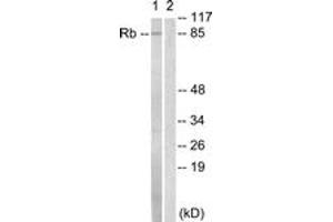 Western Blotting (WB) image for anti-Retinoblastoma Protein (Rb Protein) (AA 771-820) antibody (ABIN2888773) (Retinoblastoma Protein (Rb) anticorps  (AA 771-820))