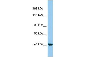 Western Blotting (WB) image for anti-KN Motif and Ankyrin Repeat Domains 4 (KANK4) (C-Term) antibody (ABIN2790793) (KANK4 anticorps  (C-Term))