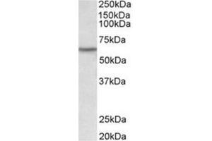 AP31924PU-N LCK antibody staining of Human Thymus lysate at 0. (LCK anticorps  (Internal Region))