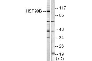 Western blot analysis of extracts from Hela cells treated with TNF-α (20ng/ml, 30min), using HSP90B (Ab-254) antibody (#B0013, Line 1 and 2). (HSP90AB1 anticorps  (Ser254))