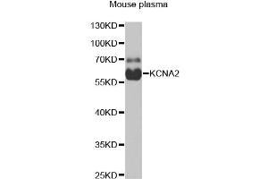 Western blot analysis of extracts of mouse plasma, using KCNA2 antibody. (KCNA2 anticorps)