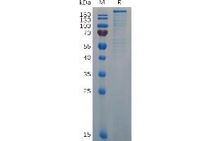 Mouse VWF (764-2813) Protein, His Tag on SDS-PAGE under reducing condition. (VWF Protein (AA 764-2813) (His tag))