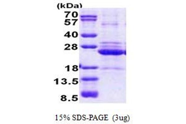 HLA-DOA Protein (AA 26-217) (His tag)