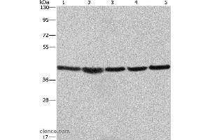 Western blot analysis of A549, NIH/3T3 and 293T cell? (RPSA/Laminin Receptor anticorps)