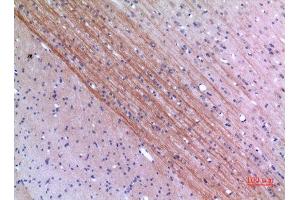 Immunohistochemistry (IHC) analysis of paraffin-embedded Rat Brain, antibody was diluted at 1:100. (LYN anticorps  (Ser780))