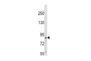 Western blot analysis of hTrkA-p (ABIN652381 and ABIN2841827) in HepG2 cell line lysates (35 μg/lane). (TrkA-pY791 (AA 769-796) anticorps)