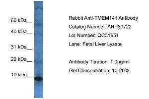 Western Blotting (WB) image for anti-Transmembrane Protein 141 (TMEM141) (C-Term) antibody (ABIN2774294) (TMEM141 anticorps  (C-Term))