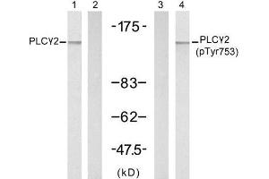 Western blot analysis of extracts from A431 cells, untreated or treated with EGF (200ng/ml, 5min), using PLCγ2 (Ab-753) antibody (E021186, Lane 1 and 2) and PLCγ2 (phospho-Tyr753) antibody (E011175, Lane 3 and 4). (Phospholipase C gamma 2 anticorps)