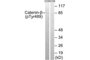Western Blotting (WB) image for anti-Catenin, beta (CATNB) (pTyr489) antibody (ABIN1847544) (beta Catenin anticorps  (pTyr489))