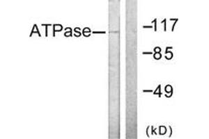 Western blot analysis of extracts from 293 cells, treated with PMA 125ng/ml 30', using ATPase (Ab-16) Antibody. (ATPase anticorps  (AA 5-54))