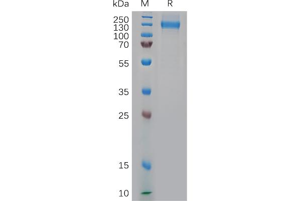 Nucleolin Protein (NCL) (AA 1-711) (His tag)