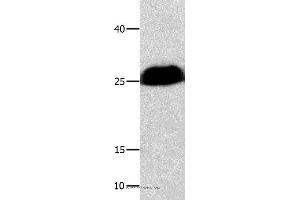 Western blot analysis of Huamn cervical cancer tissue , using BCL2L1 Polyclonal Antibody at dilution of 1:300 (BCL2L1 anticorps)
