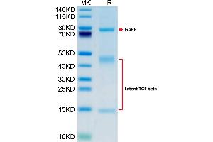 Human GARP(S138G)&Latent TGF Beta Complex on Tris-Bis PAGE under reduced condition. (GARP & Latent TGF beta 1 Complex (Ser138Glu-Mutant) protein (His-Avi Tag))