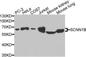 Western blot analysis of extracts of various cells, using SCNN1B antibody. (SCNN1B anticorps)