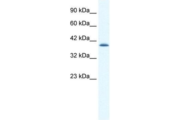 CATSPER2 anticorps  (N-Term)