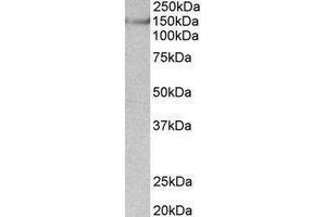 Western Blotting (WB) image for anti-Synaptic Ras GTPase Activating Protein 1 (SYNGAP1) (Internal Region) antibody (ABIN2464964) (SYNGAP1 anticorps  (Internal Region))