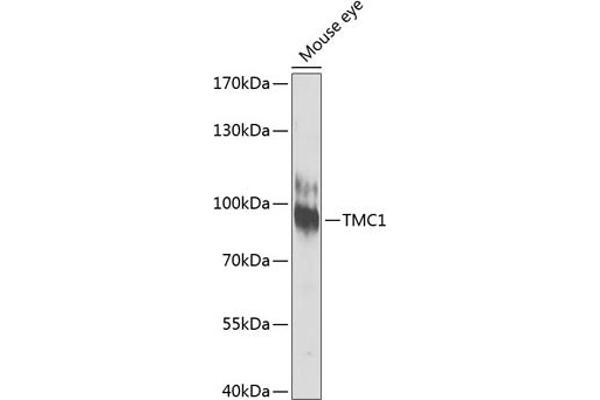 TMC1 anticorps  (AA 600-700)