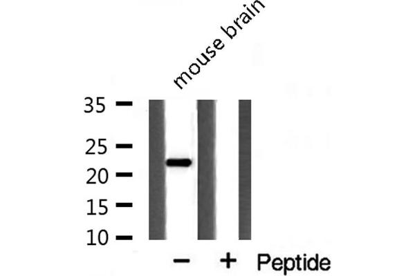 PPIF anticorps  (Internal Region)