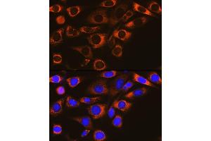 Immunofluorescence analysis of NIH-3T3 cells using F Rabbit mAb (ABIN1682600, ABIN3018533, ABIN3018534 and ABIN7101623) at dilution of 1:100 (40x lens). (FAAH anticorps)