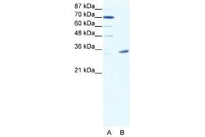 Western Blot showing MAGEA9 antibody used at a concentration of 1-2 ug/ml to detect its target protein. (MAGEA9 anticorps  (N-Term))