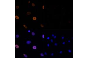 Immunofluorescence analysis of C6 cells using Acetyl-Histone H3-K56 Rabbit pAb (ABIN7267674) at dilution of 100 (40x lens). (Histone 3 anticorps  (H3K56))