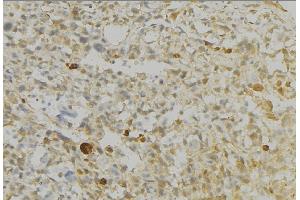 ABIN6276728 at 1/100 staining Human gastric tissue by IHC-P. (Monoamine Oxidase B anticorps  (Internal Region))