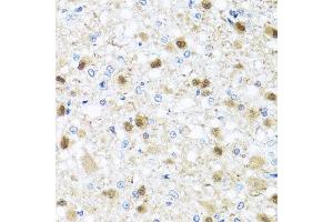 Immunohistochemistry of paraffin-embedded rat brain using ZBTB17 antibody at dilution of 1:100 (x40 lens). (ZBTB17 anticorps)