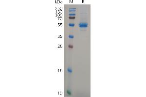 Human IL11 Protein, hFc Tag on SDS-PAGE under reducing condition. (IL-11 Protein (AA 22-199) (Fc Tag))