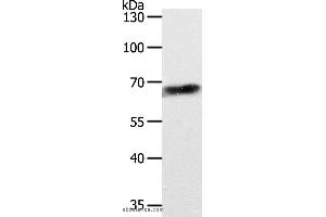 Western blot analysis of Jurkat cell, using ABCD4 Polyclonal Antibody at dilution of 1:700 (ABCD4 anticorps)