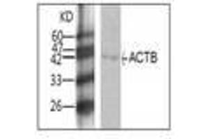 Image no. 1 for anti-Actin, beta (ACTB) antibody (ABIN791504) (beta Actin anticorps)